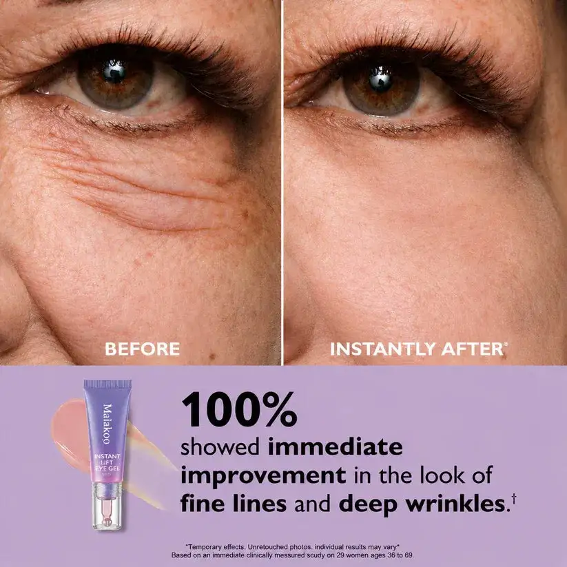 Maiakoo Instant Lift Eye Gel for Puffiness, Bags & Wrinkles - Image 6