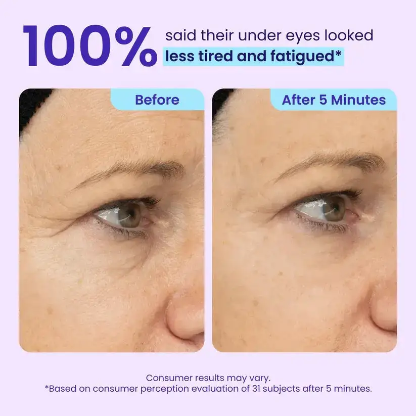 Maiakoo Instant Lift Eye Gel for Puffiness, Bags & Wrinkles - Image 8