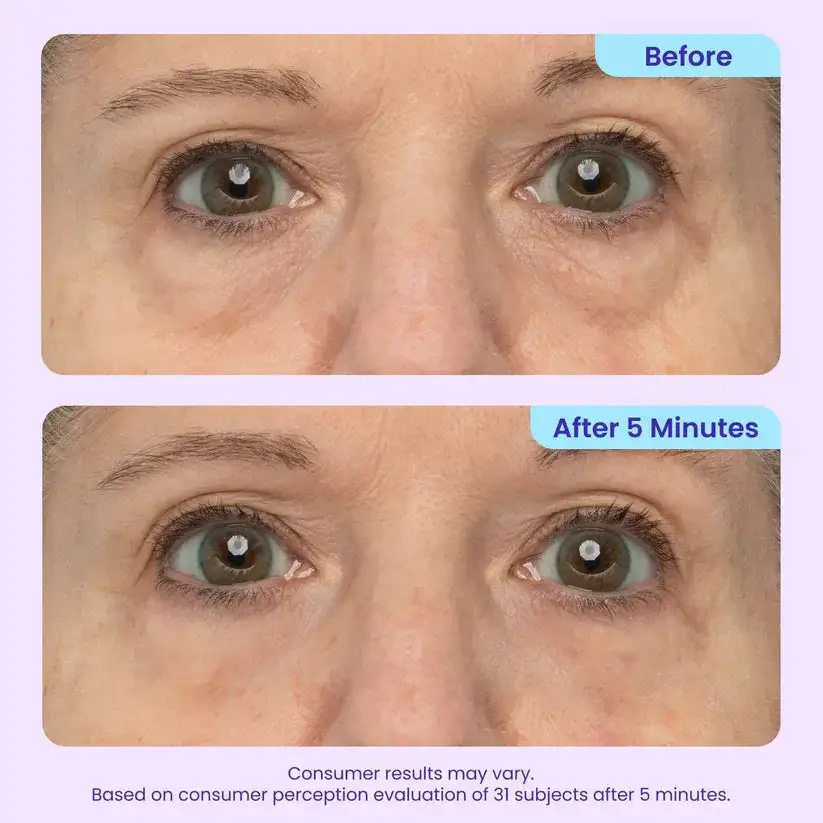 Maiakoo Instant Lift Eye Gel for Puffiness, Bags & Wrinkles - Image 9