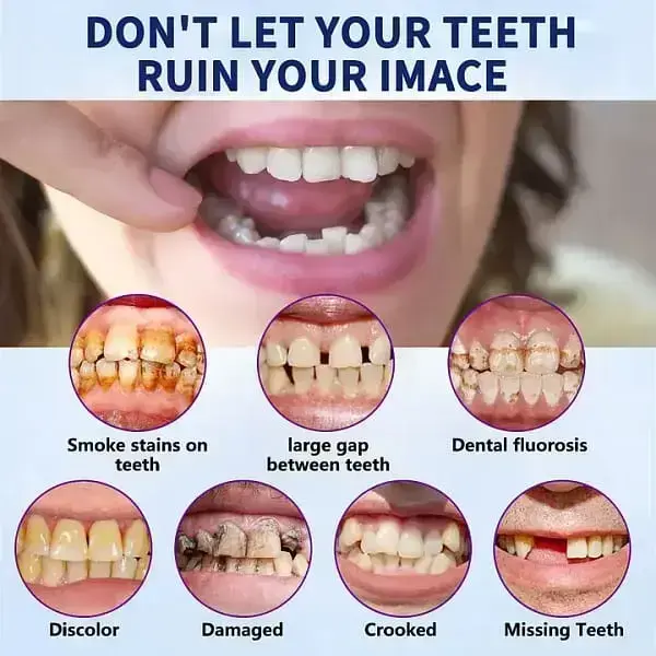 Advanced Customized Full Denture Set - Image 10