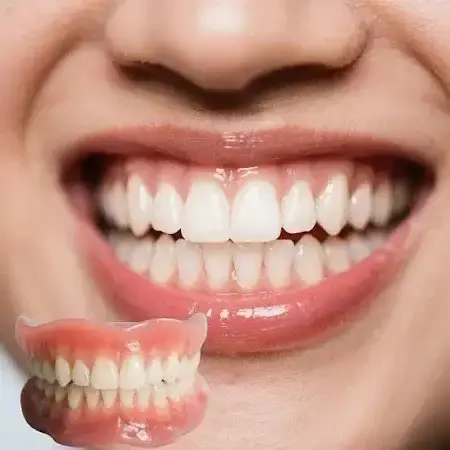 Full Dentures | Adaptive Gel Fit - Image 2