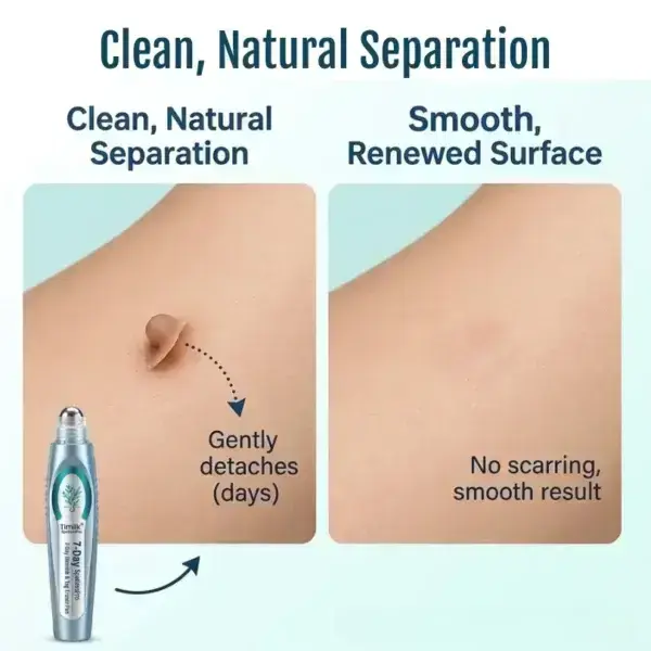 SpotlessPro Advanced Skin Care Pen - Image 7