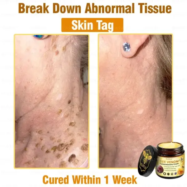 Bee Venom Comprehensive Cream - Image 3