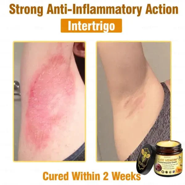 Bee Venom Comprehensive Cream - Image 6