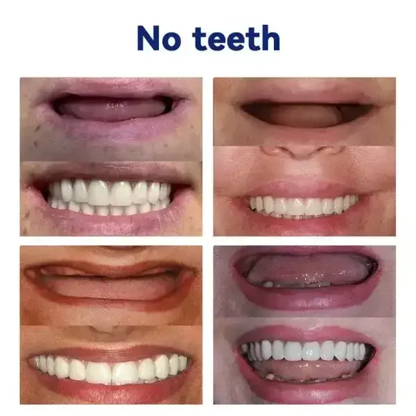 Ease Dentures - Image 7