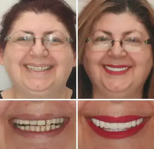 PREMIUM DENTURES - Image 2