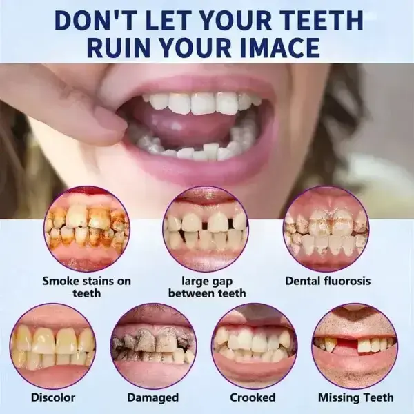 Advanced Full Denture Set - Image 11