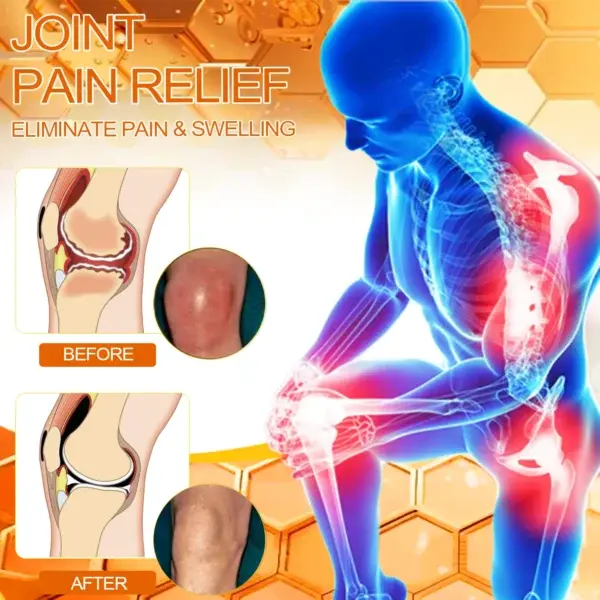 Bee Venom Instant Ultra Strength Pain Relief Therapy Cream - Image 10