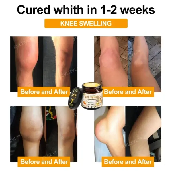 Bee Venom Instant Ultra Strength Pain Relief Therapy Cream - Image 5