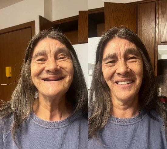 DentoFuse Dentures