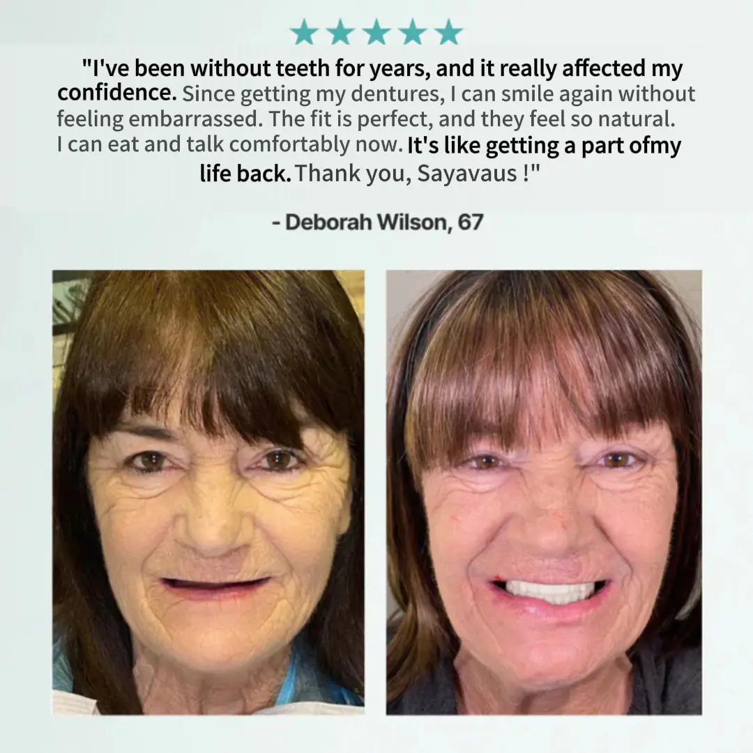 2026 NEW Upgraded 2.0🏆🌎Ends Today: 70% OFF! Full Denture with Strong Suction - Image 16