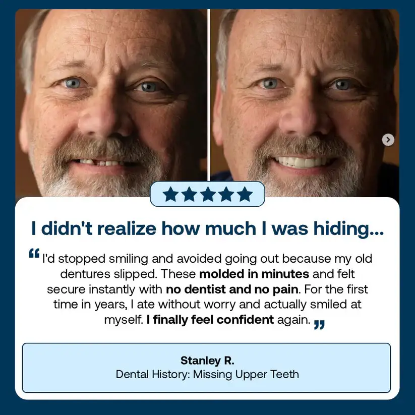 2026 NEW Upgraded 2.0🏆🌎Ends Today: 70% OFF! Full Denture with Strong Suction - Image 17