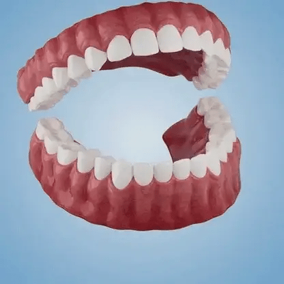 2026 NEW Upgraded 2.0🏆🌎Ends Today: 70% OFF! Full Denture with Strong Suction - Image 2