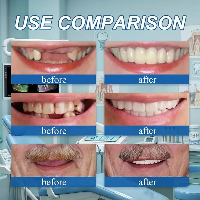 2026 NEW Upgraded 2.0🏆🌎Ends Today: 70% OFF! Full Denture with Strong Suction - Image 4