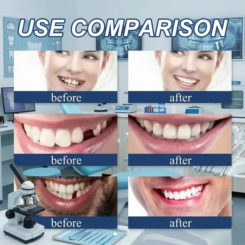 2026 NEW Upgraded 2.0🏆🌎Ends Today: 70% OFF! Full Denture with Strong Suction - Image 5