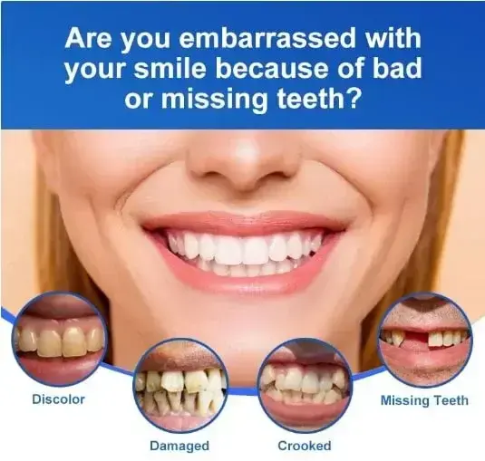 Adsorption Dentures - Image 4