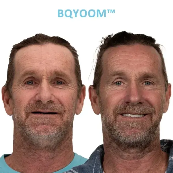 At Home Custom Dentures - Image 3
