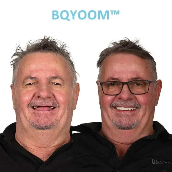 At Home Custom Dentures - Image 4