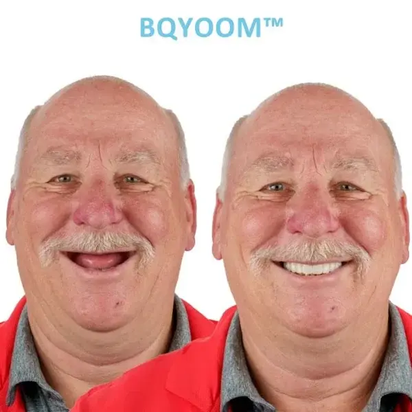 At Home Custom Dentures - Image 6