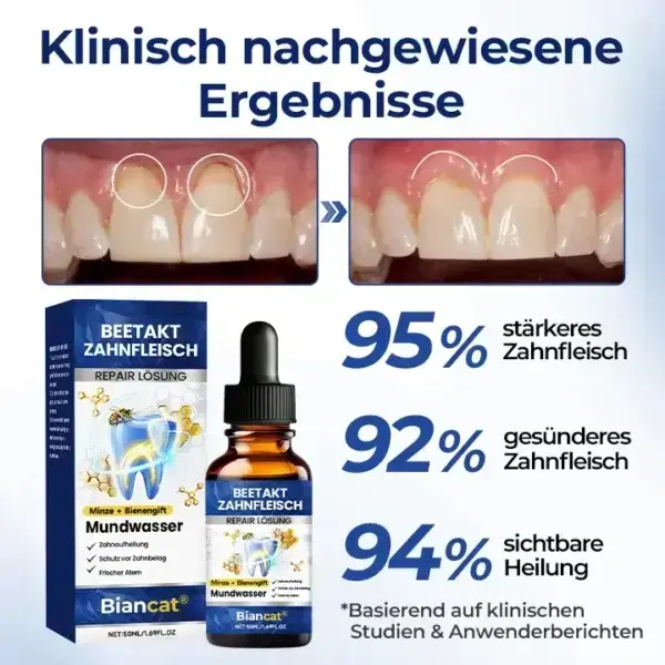 BeeTakt Zahnfleisch-Repair Lösung - Image 3