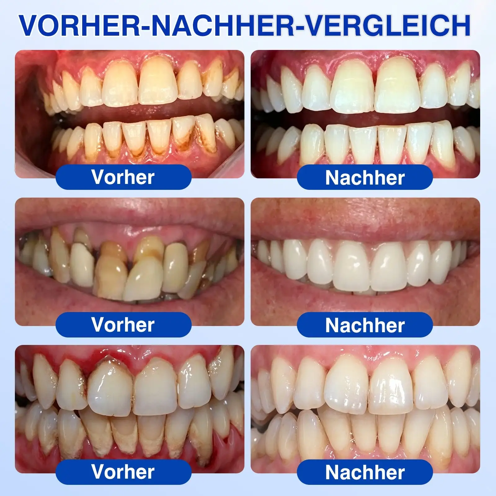 GumRevive Parodontales Reparaturgel - Image 4