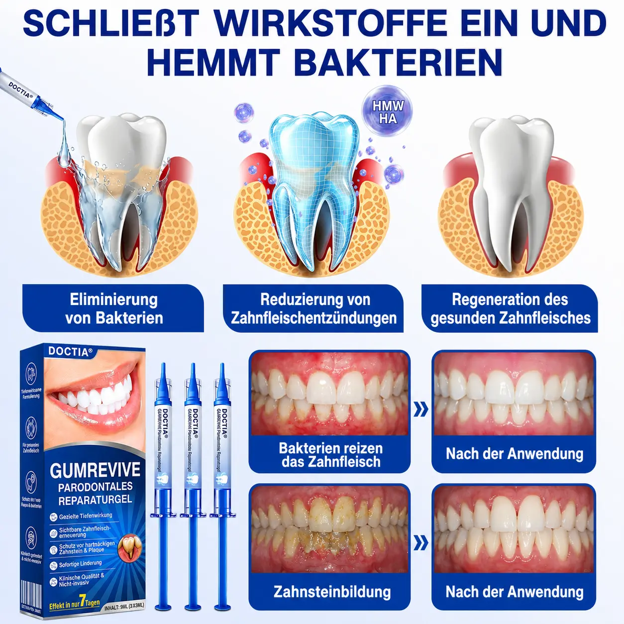 GumRevive Parodontitis Reparaturgel - Image 9