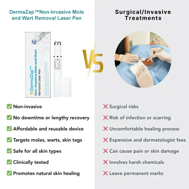 Non-Invasive Mole and Wart Removal Laser Pen - Image 5
