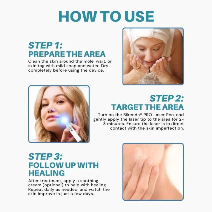 Non-Invasive Mole and Wart Removal Laser Pen - Image 8