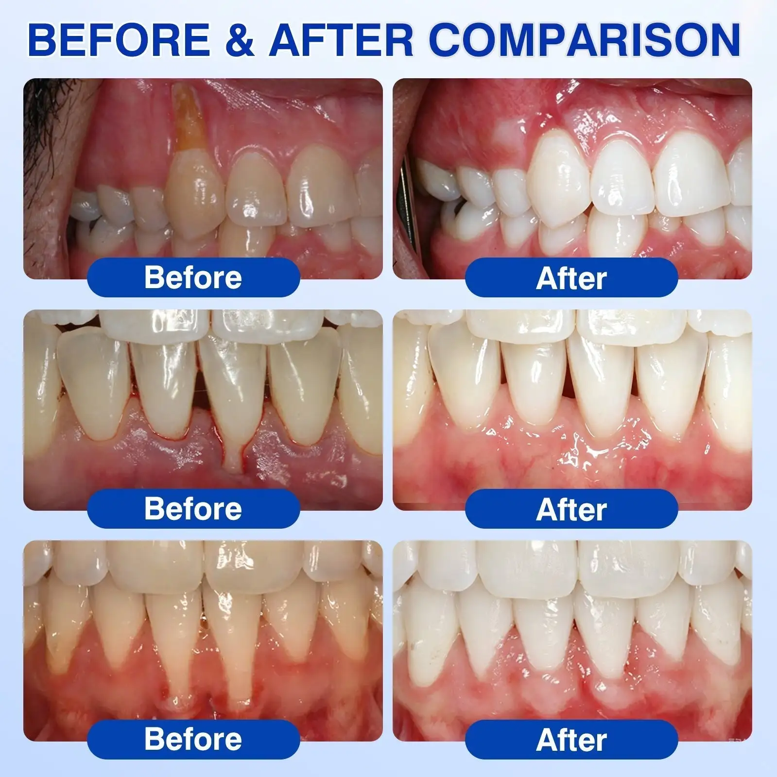 GumRevive Advanced Gum Care Gel - Image 2