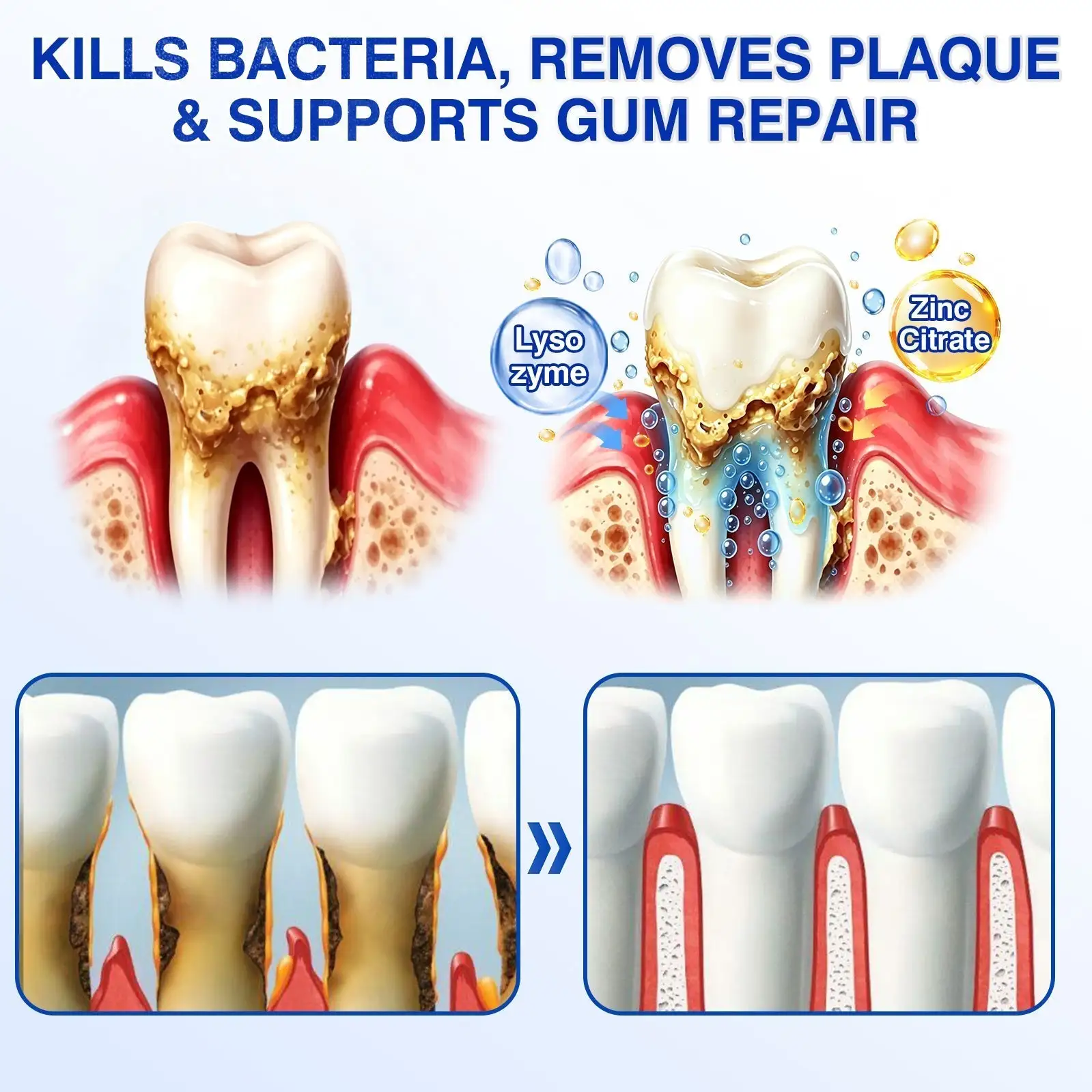 GumRevive Periodontal Repair Gel - Image 8