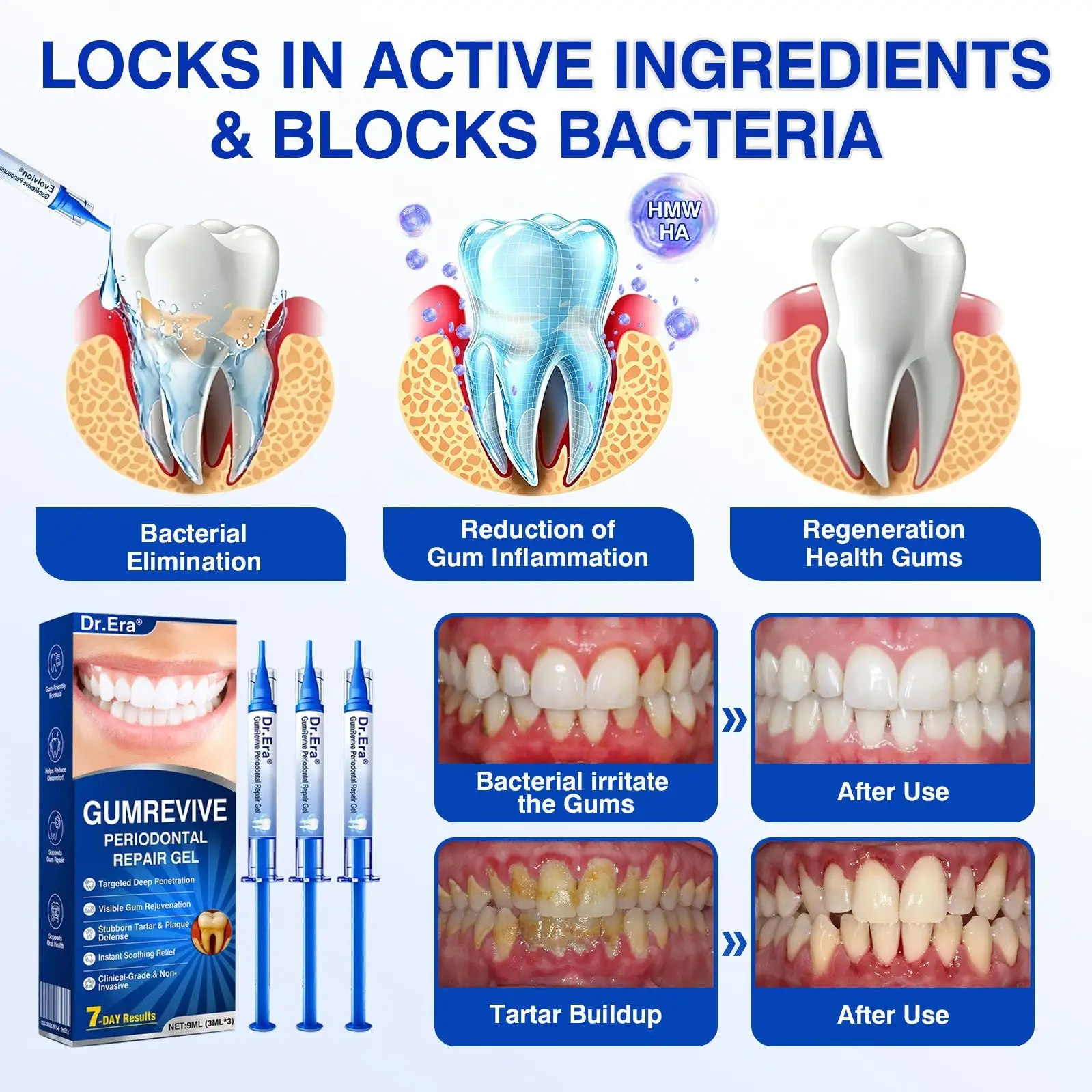 GumRevive Periodontal Repair Gel - Image 9