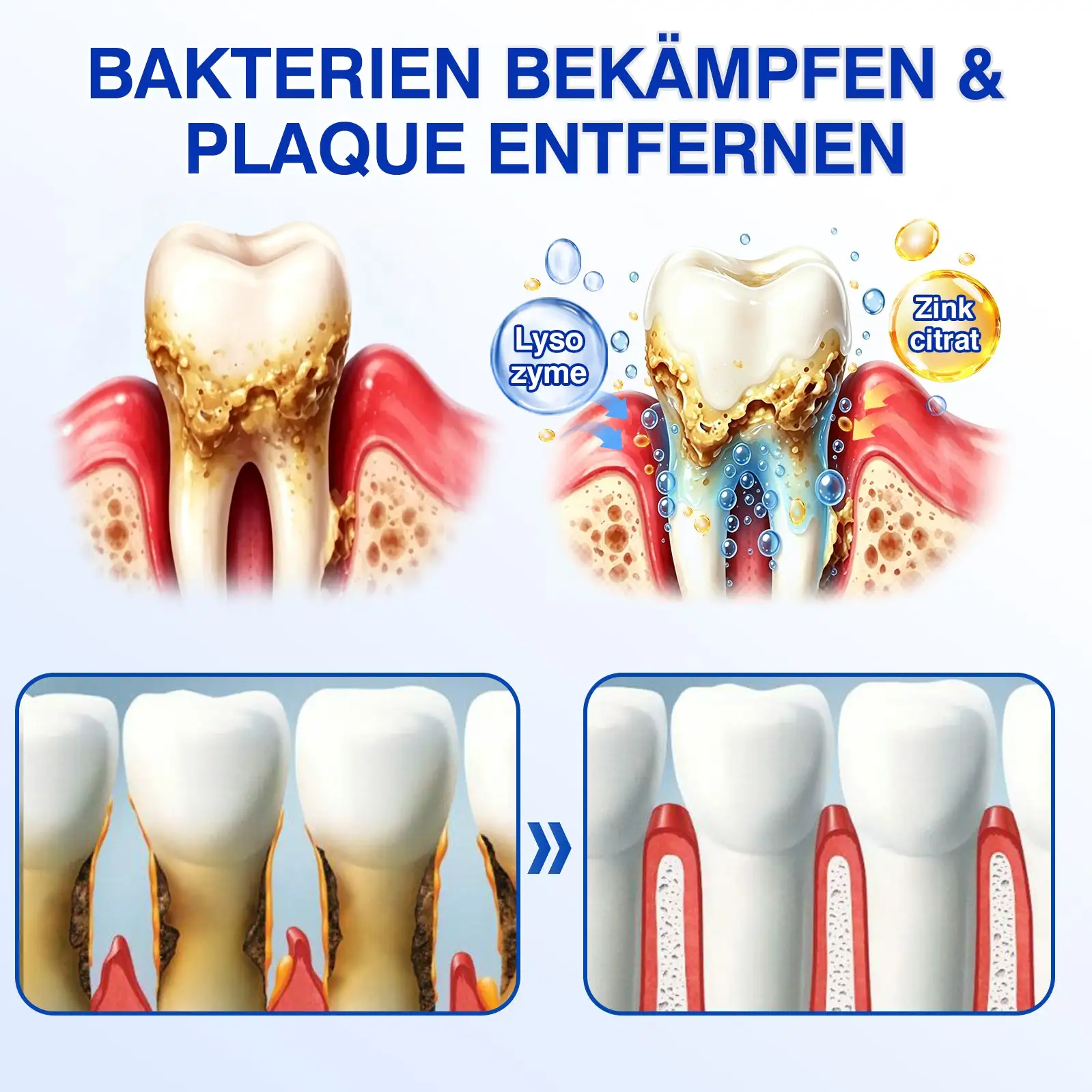 GumRevive Parodontales Reparaturgel - Image 8