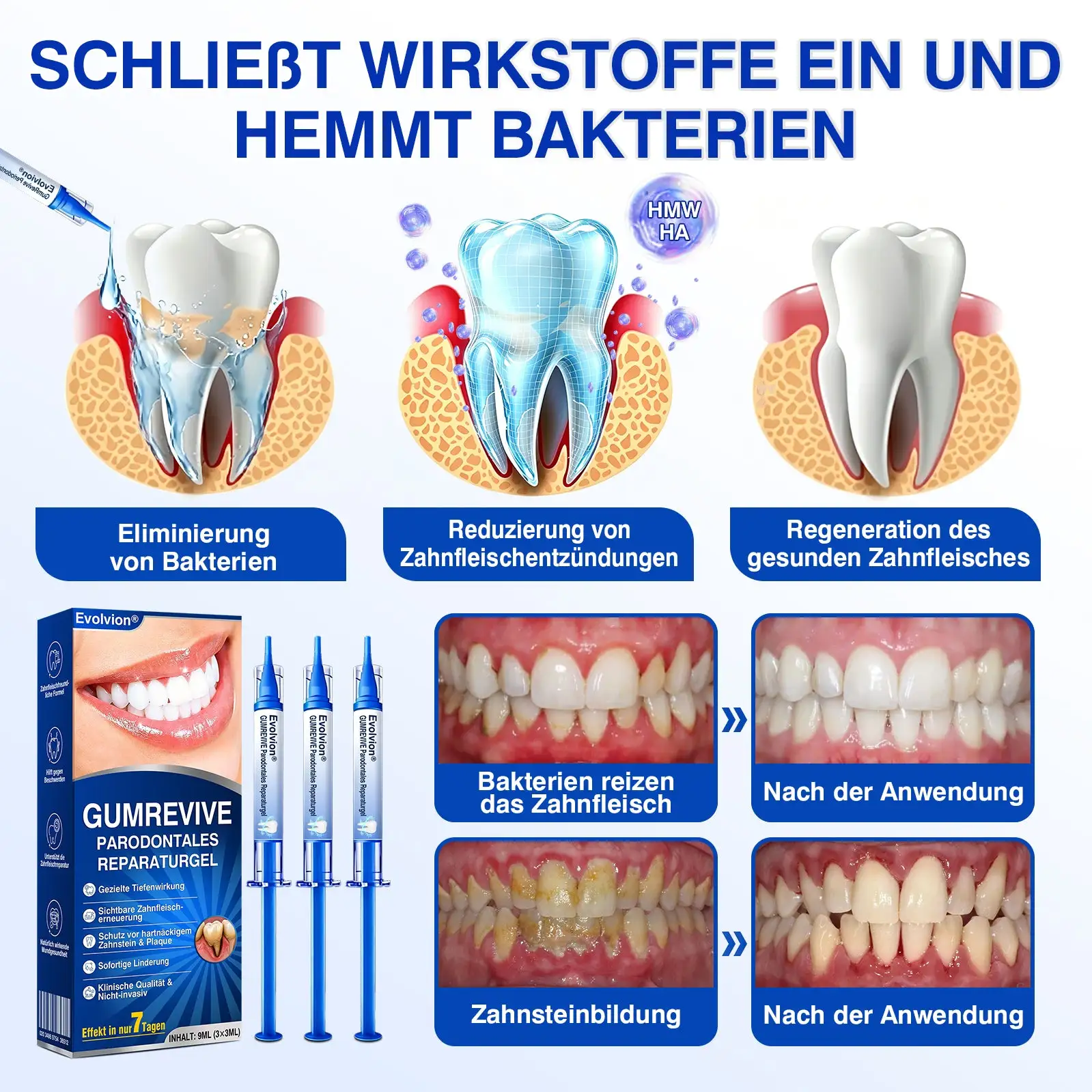 GumRevive Parodontales Reparaturgel - Image 9