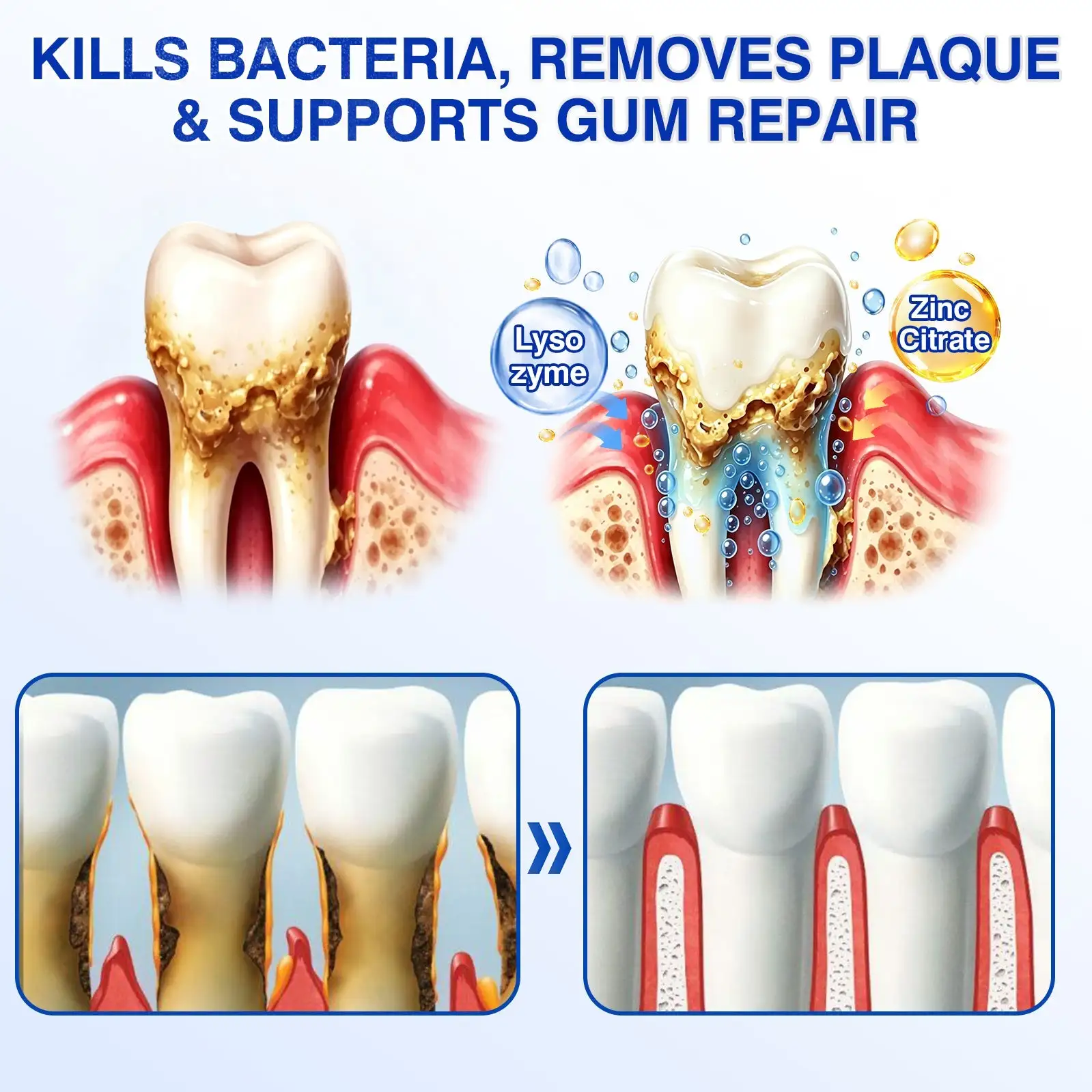 GumRevive Periodontal Repair Gel - Image 8