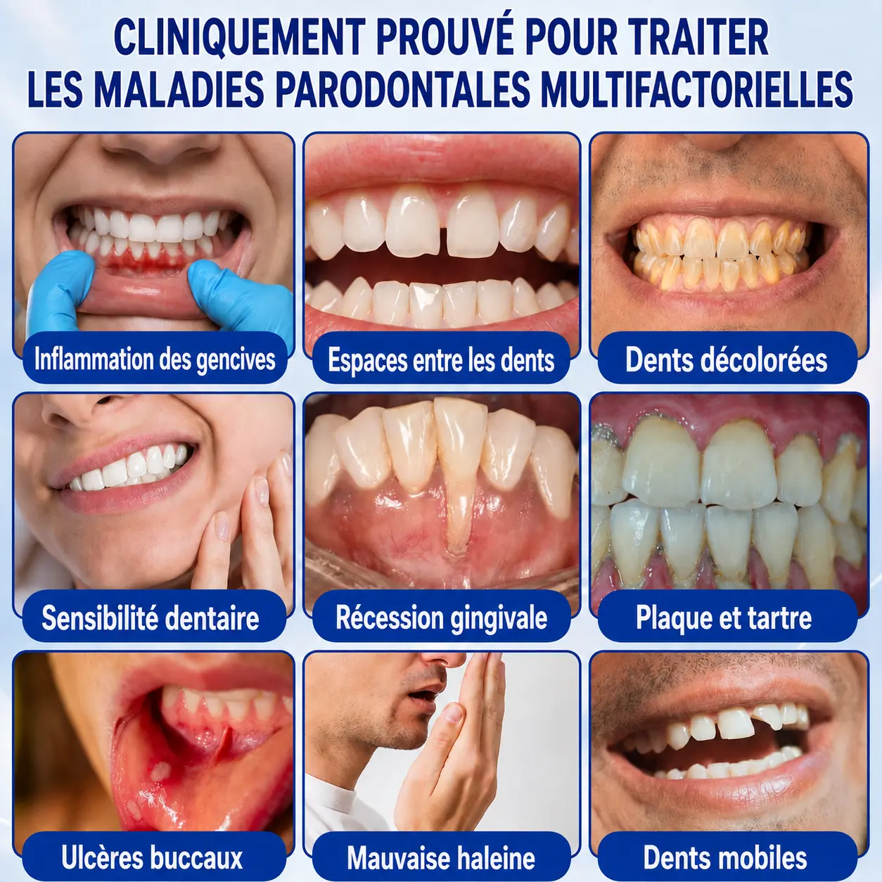 GumCare Pro : Gel Parodontal de Précision - Image 6