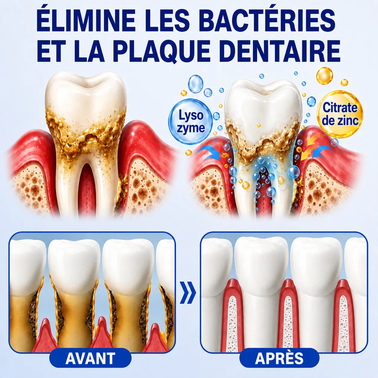 GumCare Pro : Gel Parodontal de Précision - Image 8