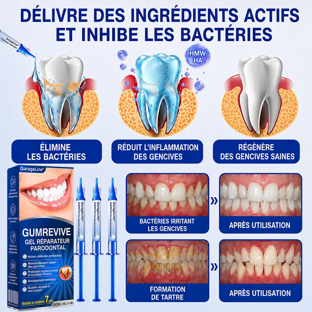 GumCare Pro : Gel Parodontal de Précision - Image 9