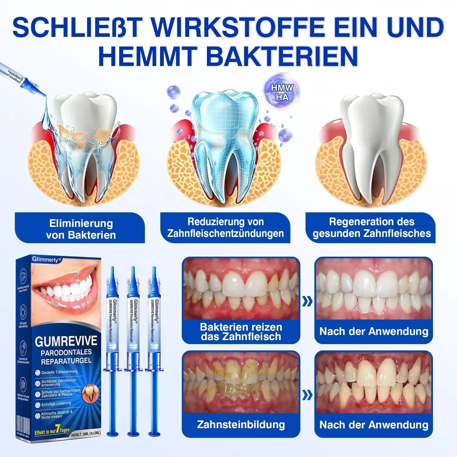 GumRevive Parodontales Reparaturgel - Image 9
