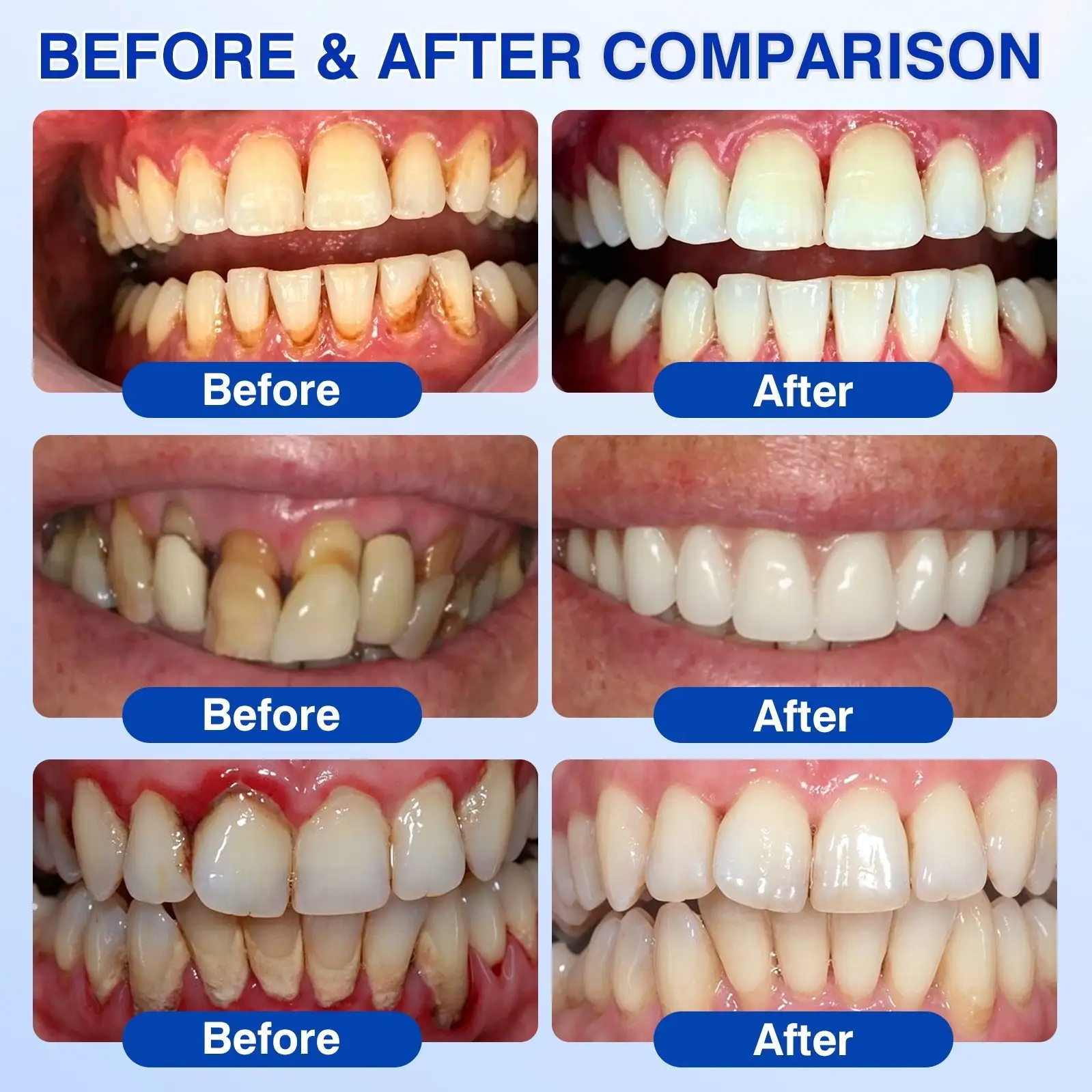 GumRevive Periodontal Repair Gel - Image 10