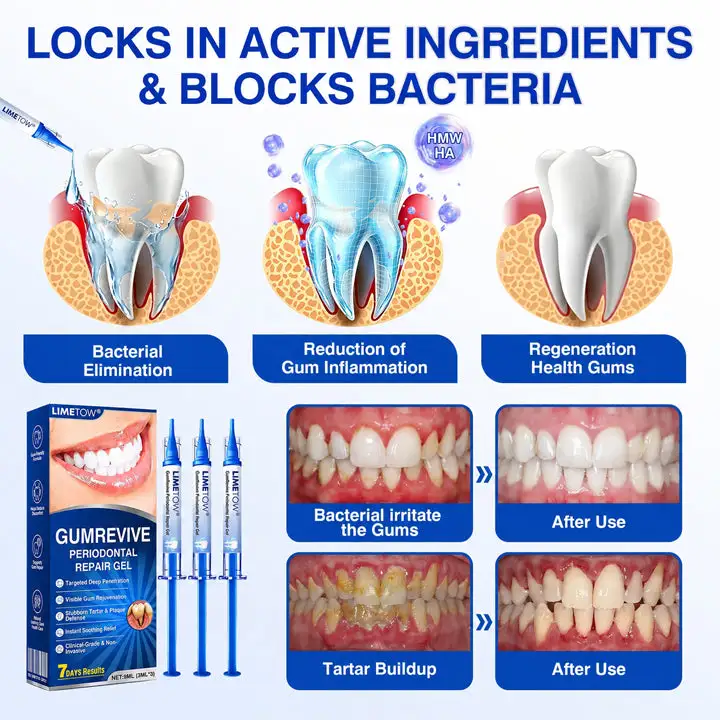 GumRevive Periodontal Repair Gel - Image 14