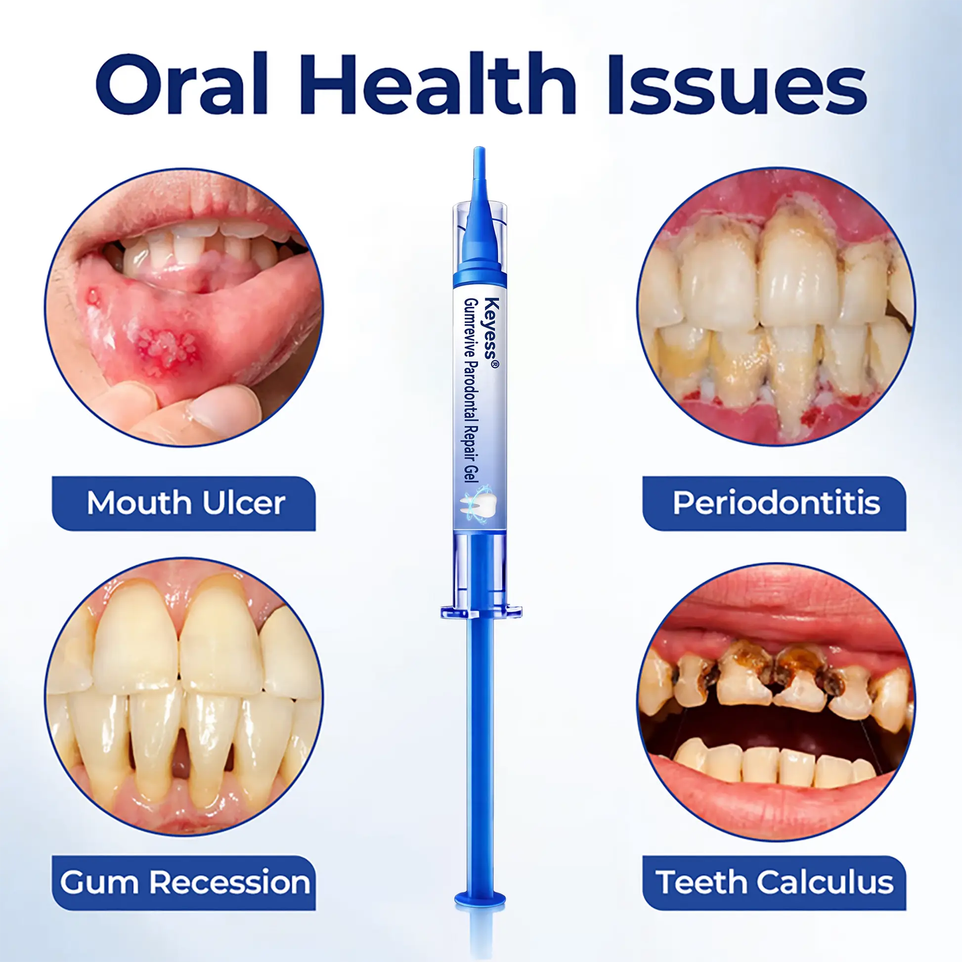 GumRevive Periodontal Repair Gel - Image 2