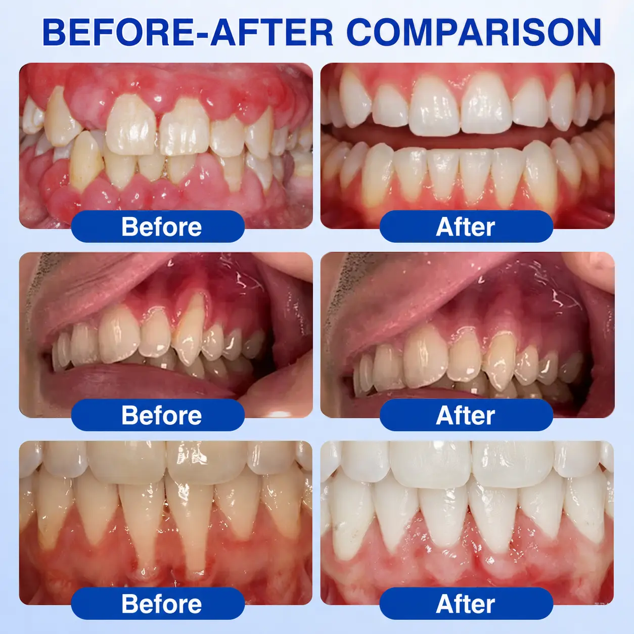 GumRevive Periodontal Repair Gel - Image 3