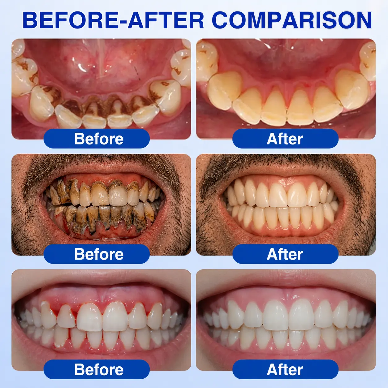 GumRevive Periodontal Repair Gel - Image 4