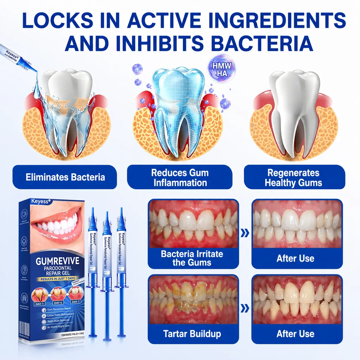GumRevive Periodontal Repair Gel - Image 9