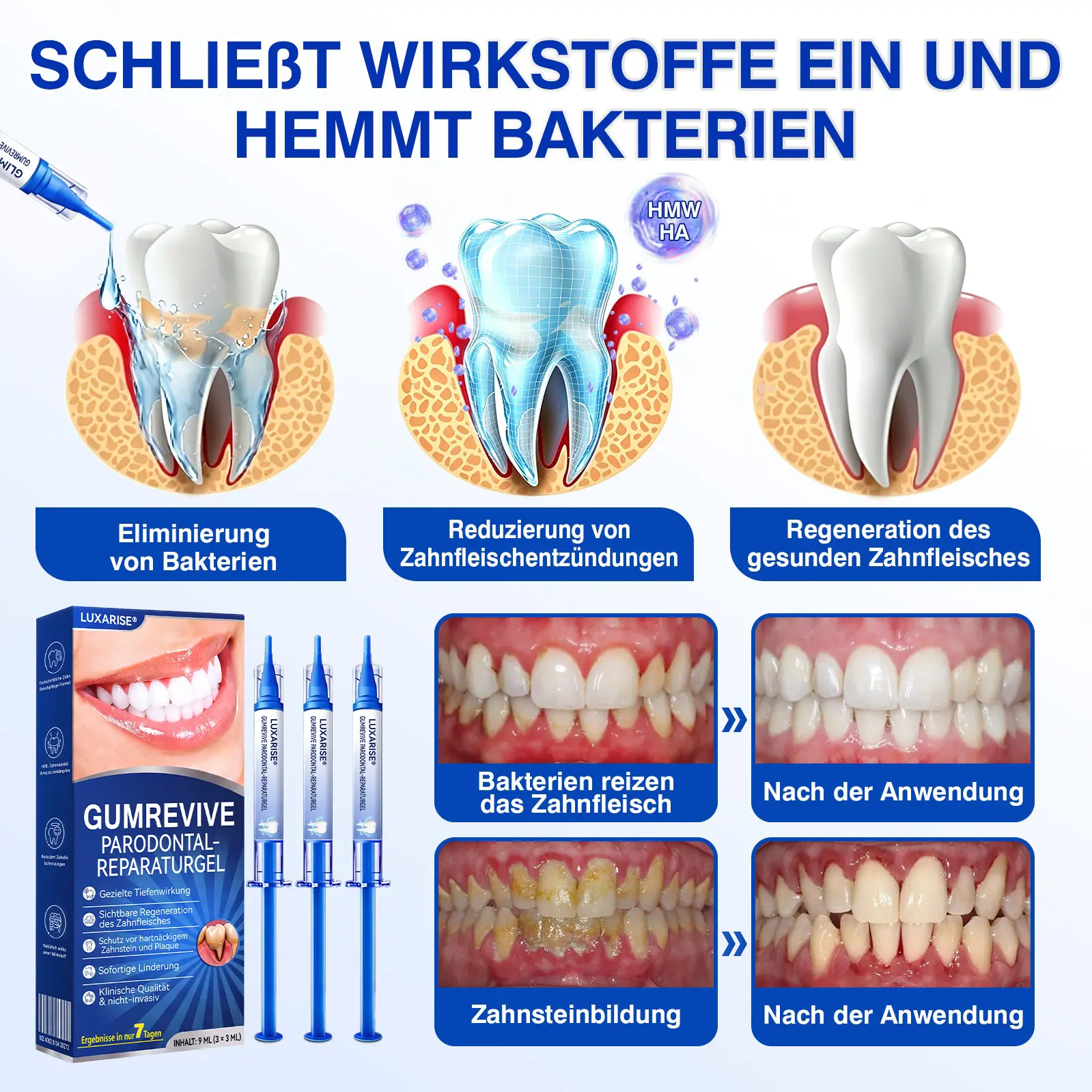 GumRevive Parodontal-Reparaturgel - Image 8