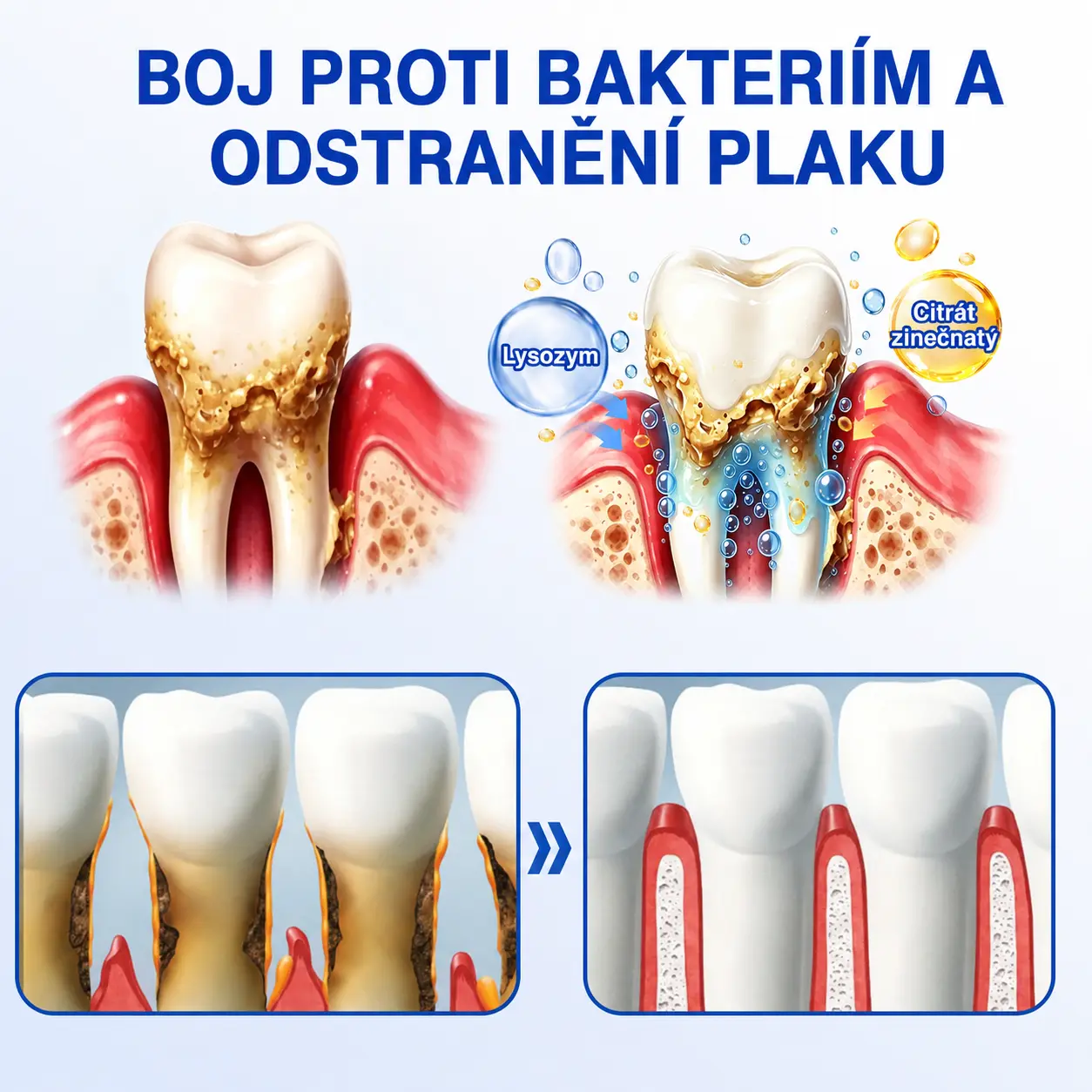 🇨🇿 🦷 GumRevive parodontální opravný gel🥚 - Image 5