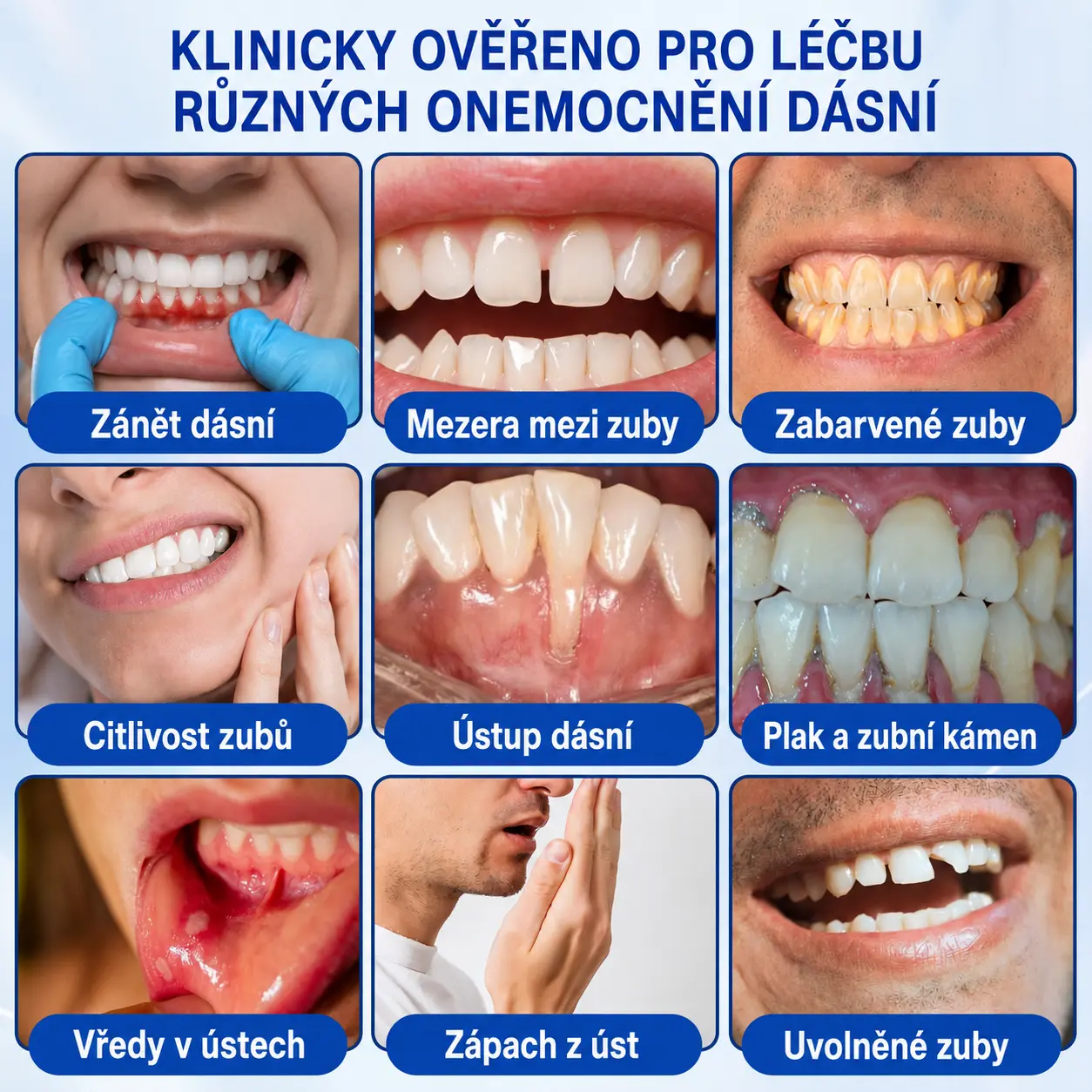 🇨🇿 🦷 GumRevive parodontální opravný gel🥚 - Image 8