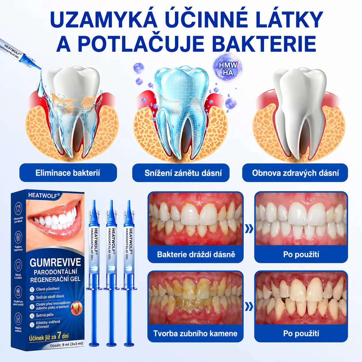 🇨🇿 🦷 GumRevive parodontální opravný gel🥚 - Image 9
