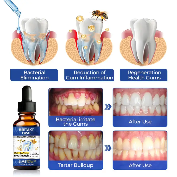 BeeTakt Oral Repair Solution - Image 2