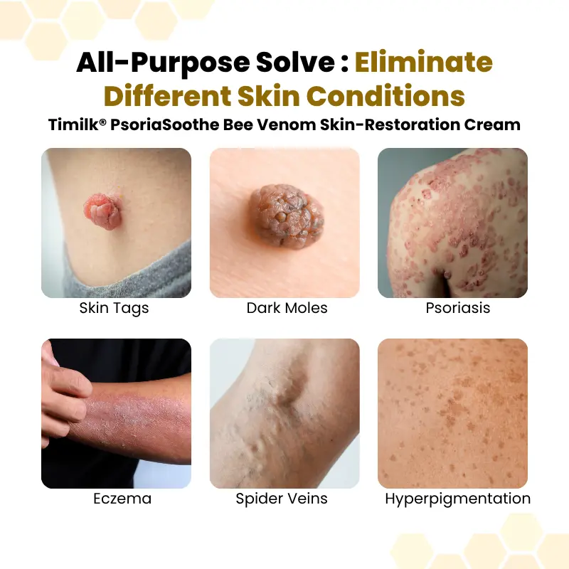 PsoriaSoothe Skin Care Cream - Image 7